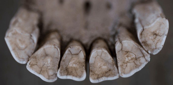 What Is Teeth Floating?